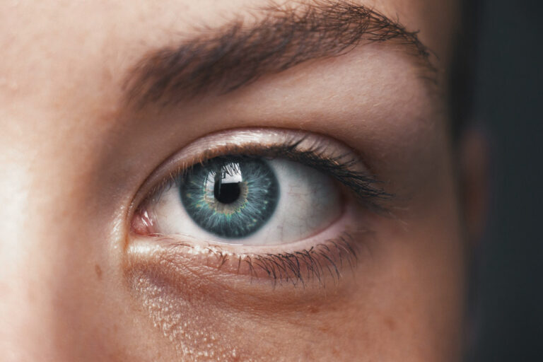 Hyaluronsäure gegen Augenringe – die Fakten!