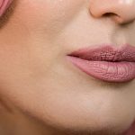 1600-violetfleur-violet-fleur-nadjanemetz-nadja-nemetz-austrianblogger-austrian-blogger-beautyblogger-lippen-lips-lippenkorrektur-hyaluron-spritzen-spritze-filler-